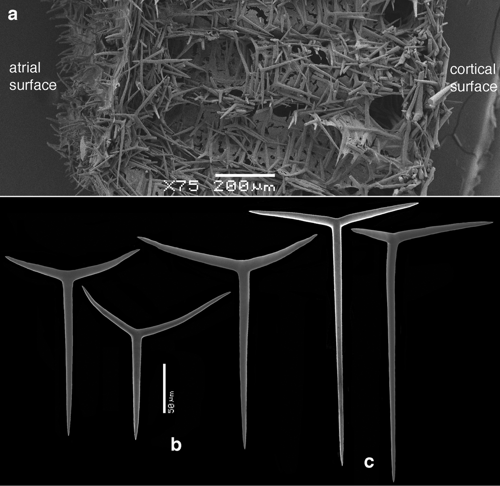 w.m Microscope Slide Grantia Isolated Spicules